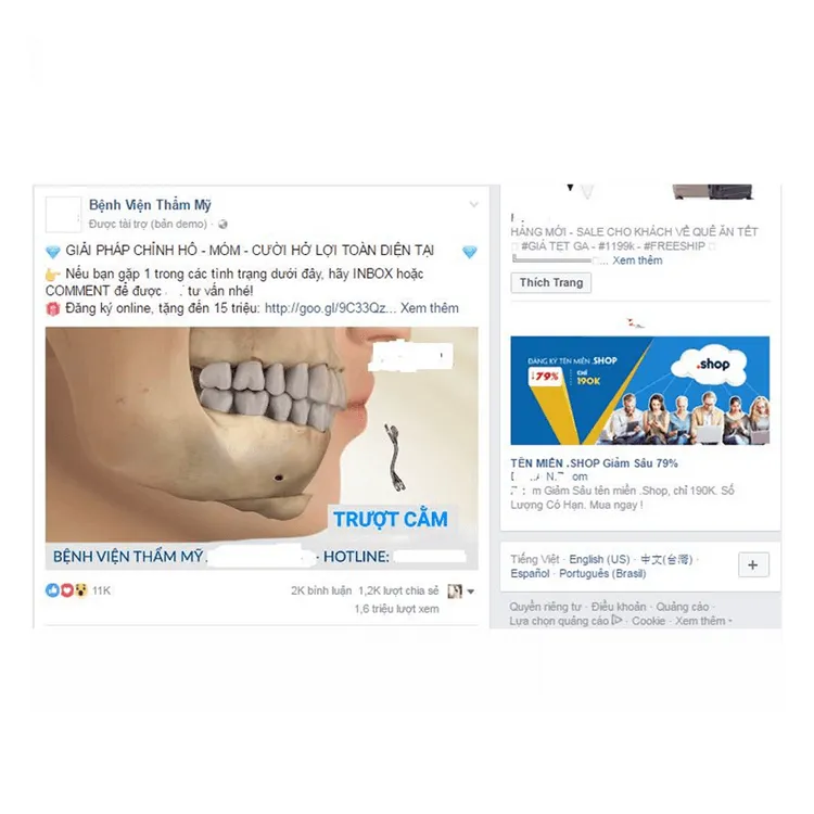 Quảng cáo bài viết